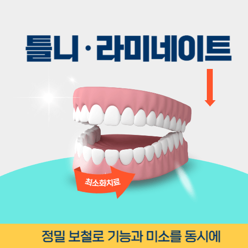 아산치과 아산시 치과 틀니 라미네이트
